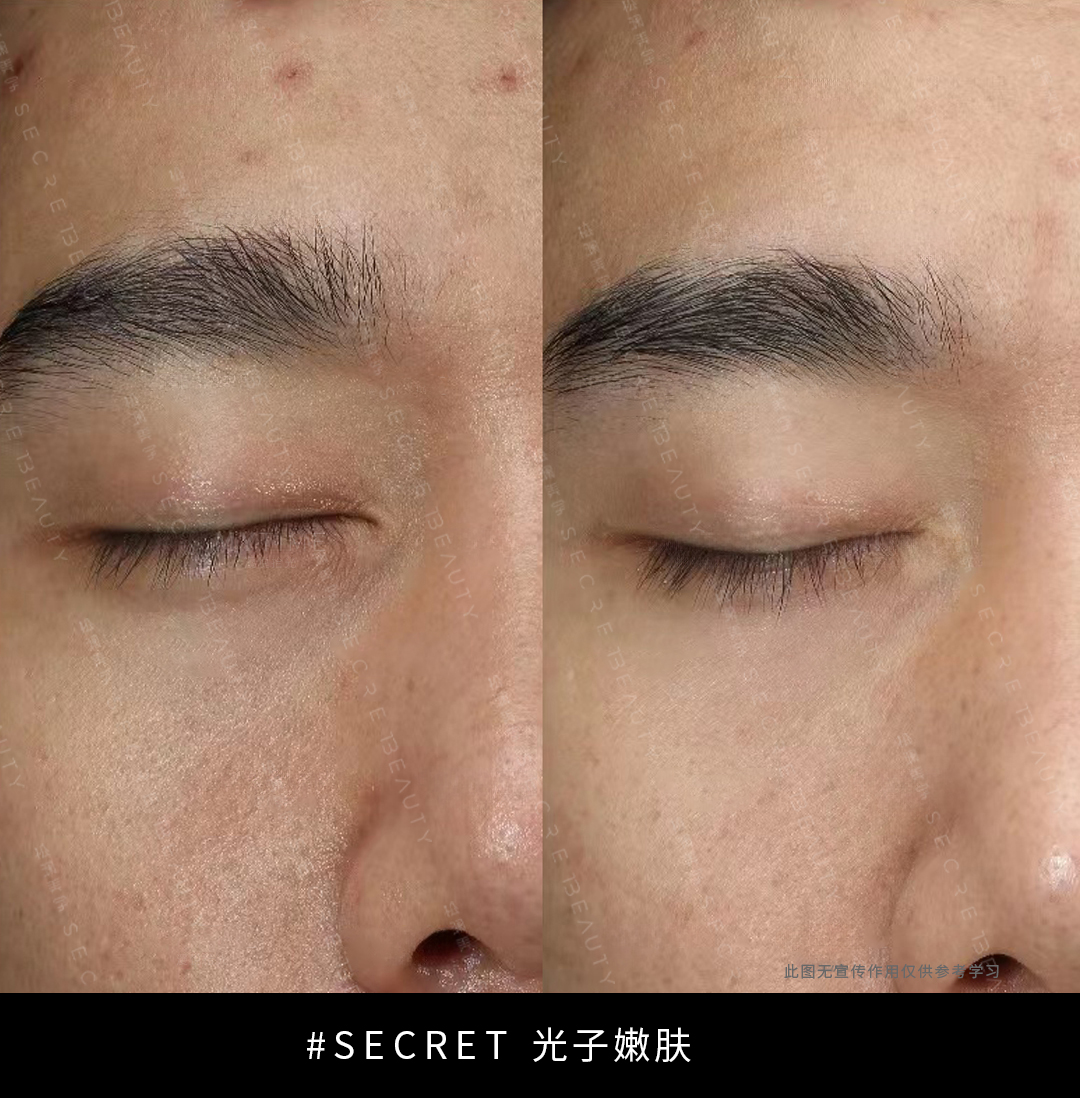 光子1.jpg 光子1.jpg